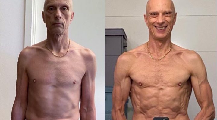 Mickebeforeafter