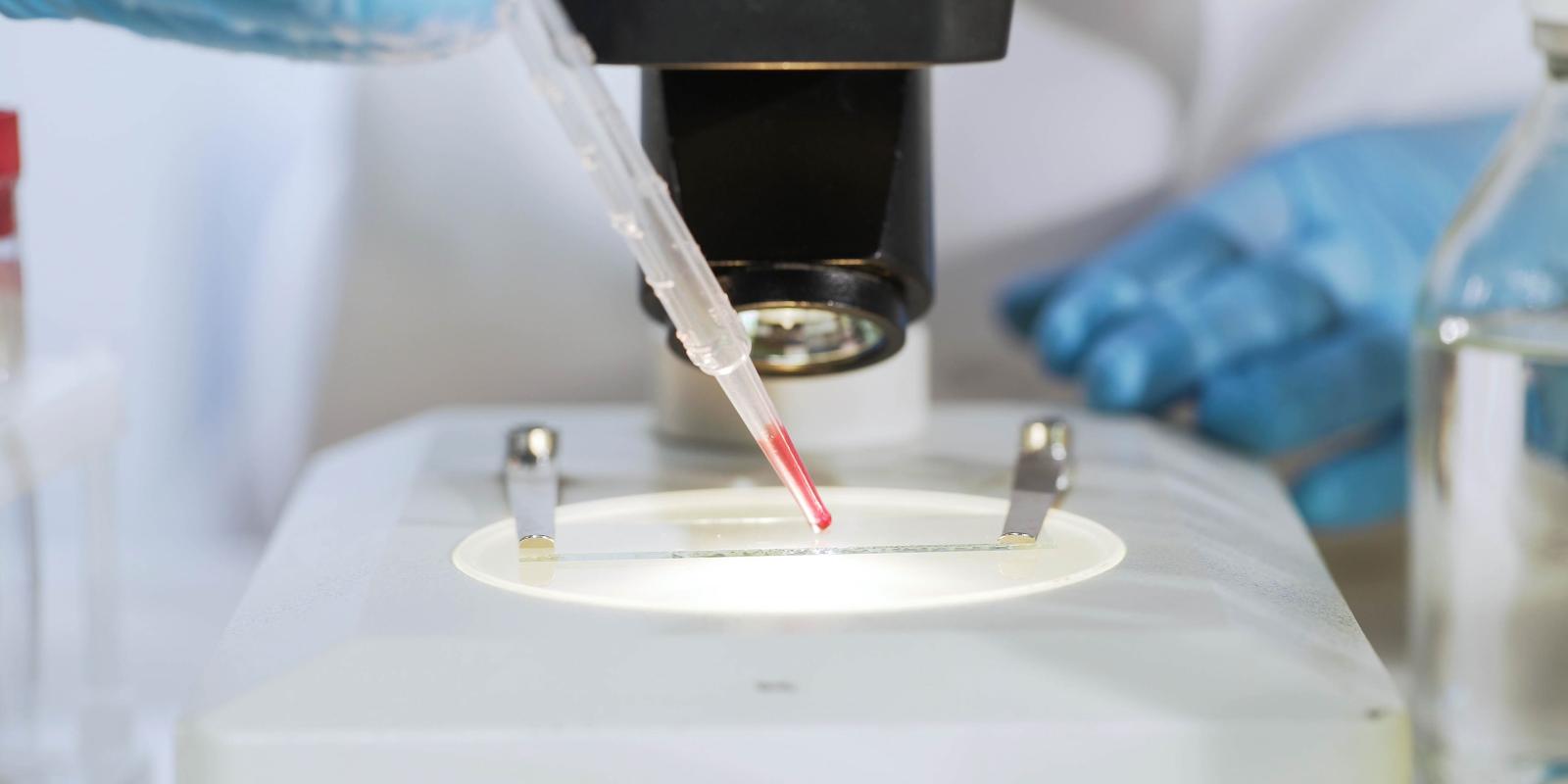 Närbild av en laboratoriescen med en handskförsedd hand som håller en pipett som fördelar en röd vätska på ett objektglas under ett mikroskop.