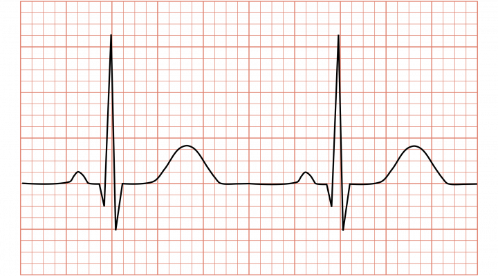 ECG Graph