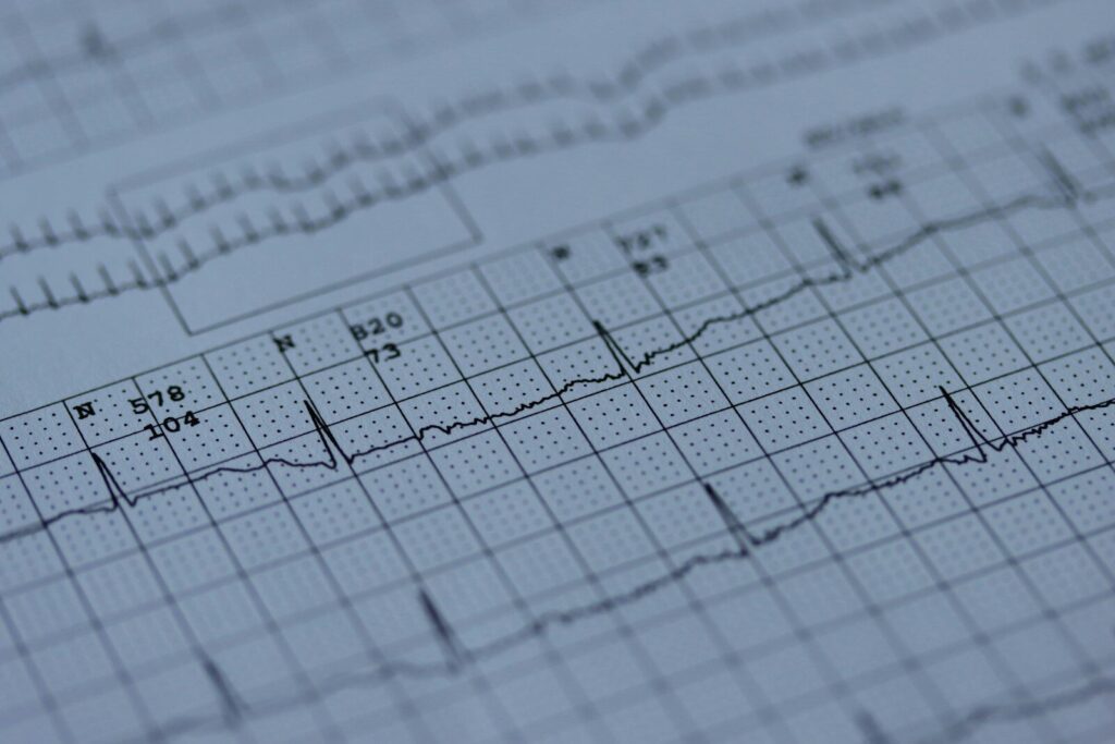 Långtids EKG - Aktivitus Långtids EKG